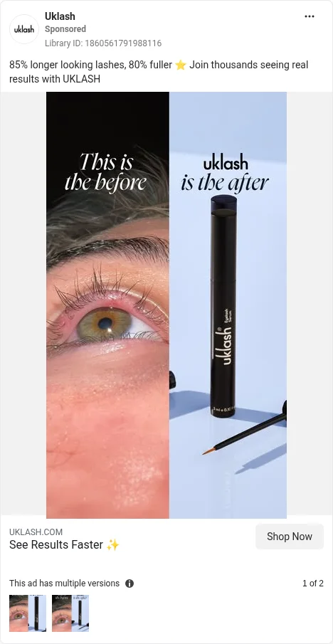 Based on Ad Library ID 1860561791988116, UKLASH, closest live GB card: lash before/after split. FLAG: no "results vary" or date.
